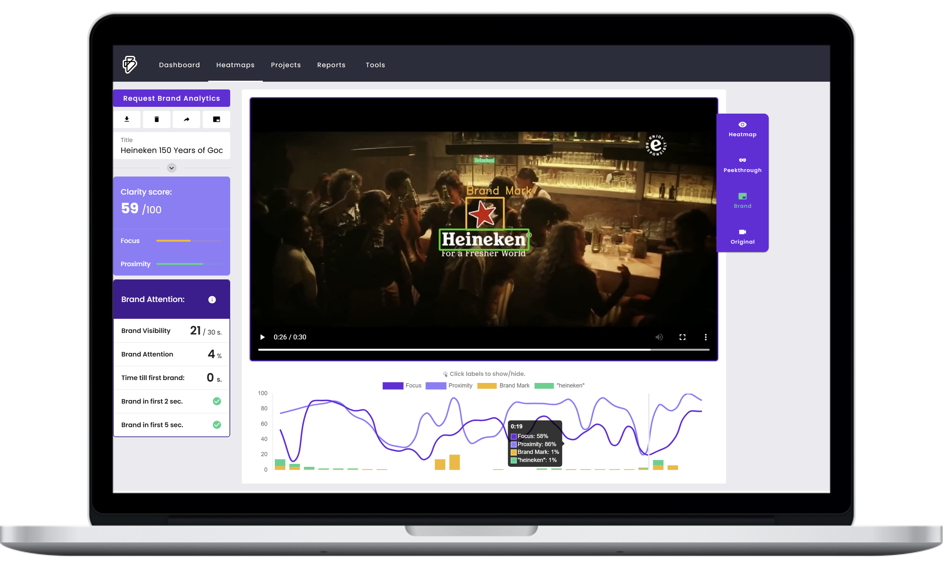 Brainsight Screenshot
