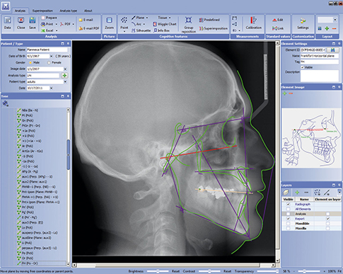 Planmeca Romexis screenshot & Video