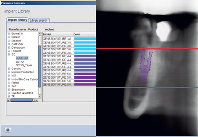 Planmeca Romexis screenshot & Video