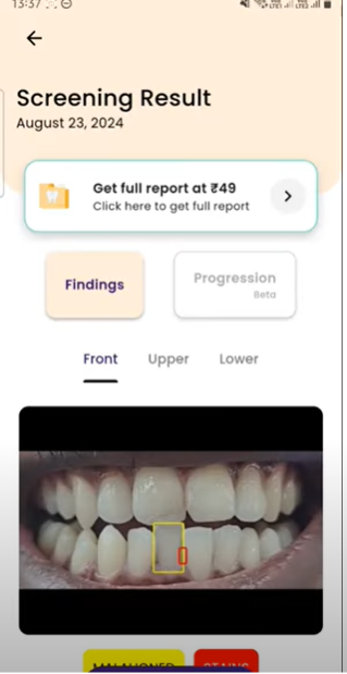 scanO AI Dental App Screenshot