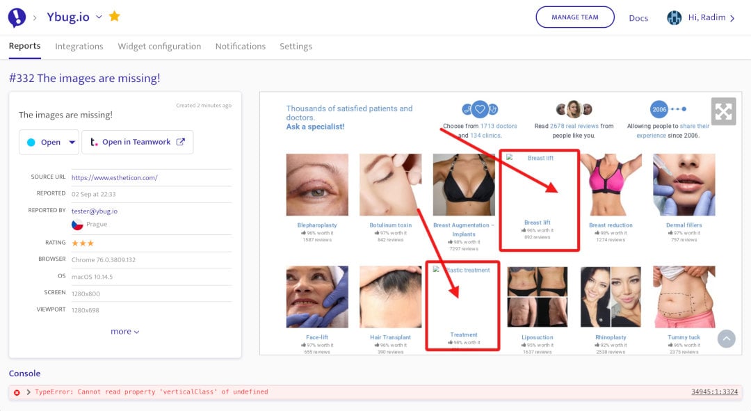 Ybug screenshot & Video